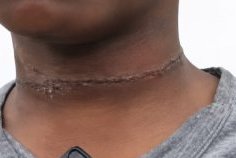 Violences sur mineur au PK18&nbsp;: une mère arrêtée, l’enfant pris en charge